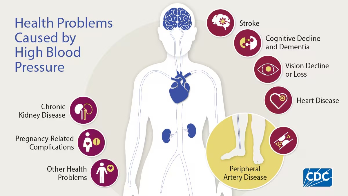 long-term blood pressure symptoms